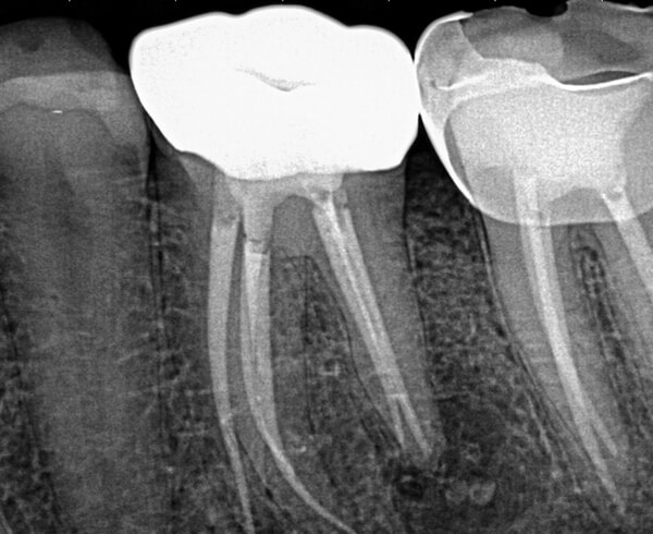 Case-Study-1-Post-Op-2-1.jpg